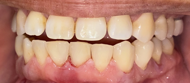 beforeafter