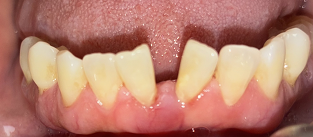 beforeafter
