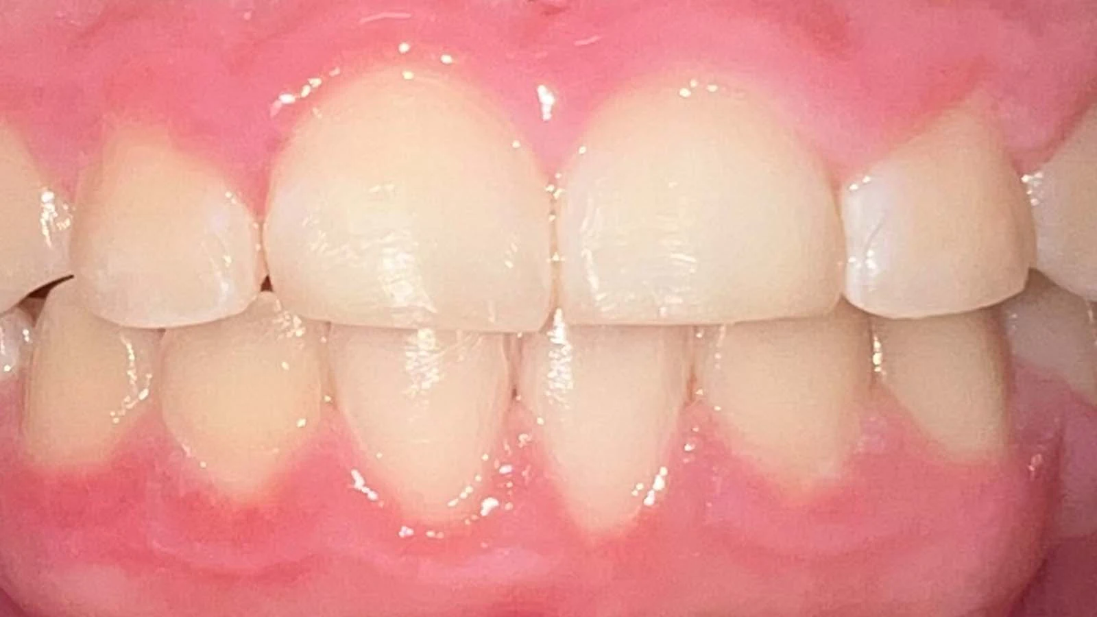 After image