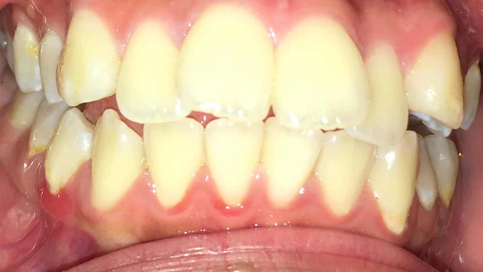 Before image