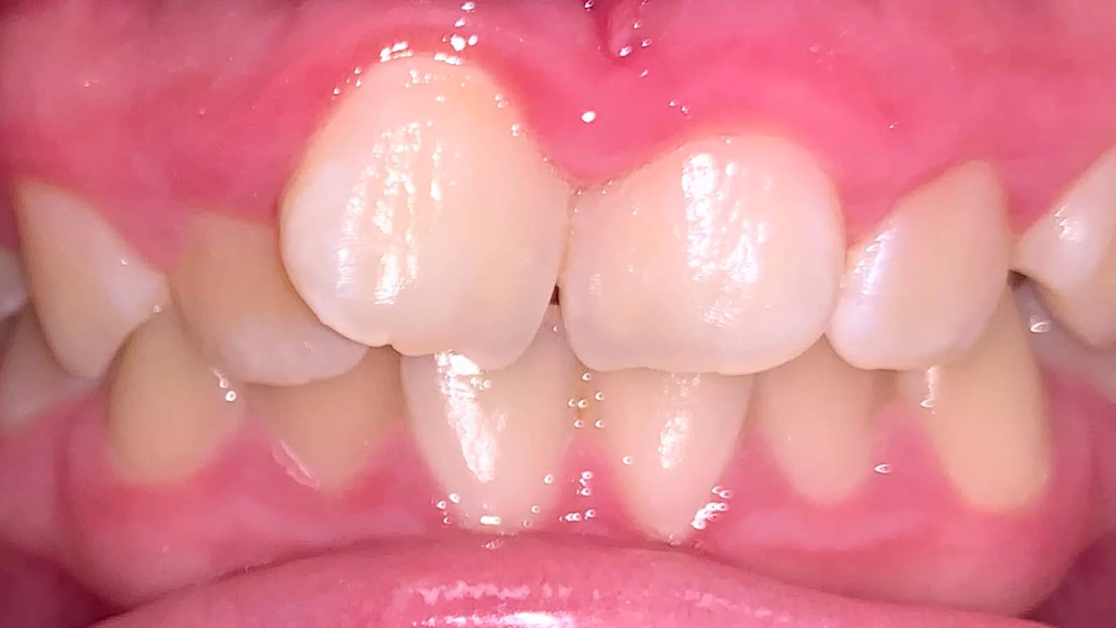 Before image
