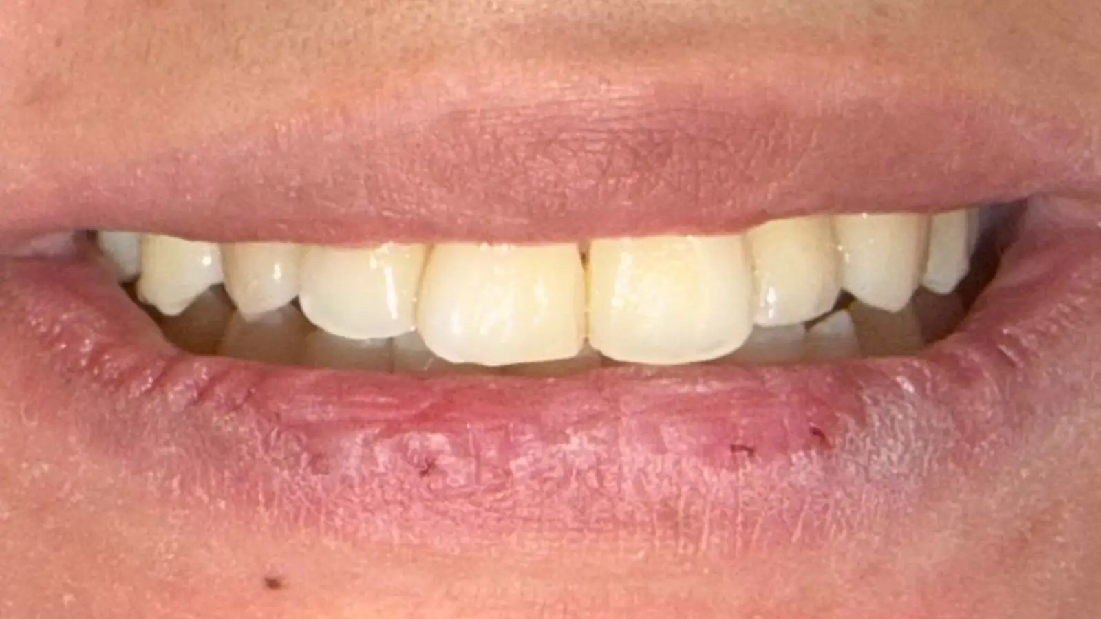 After image