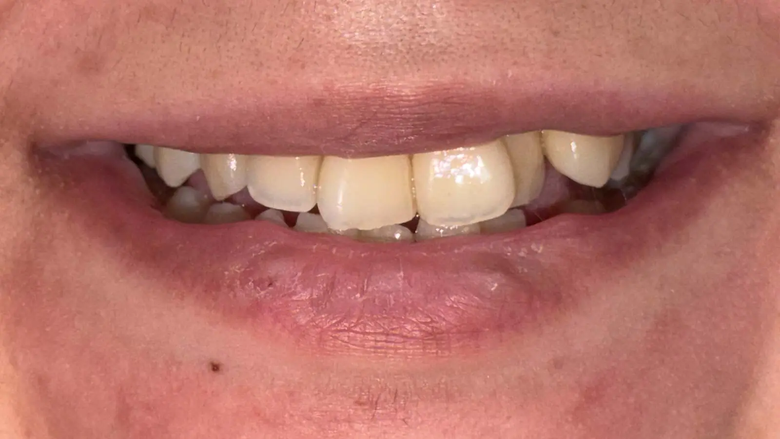 Before image