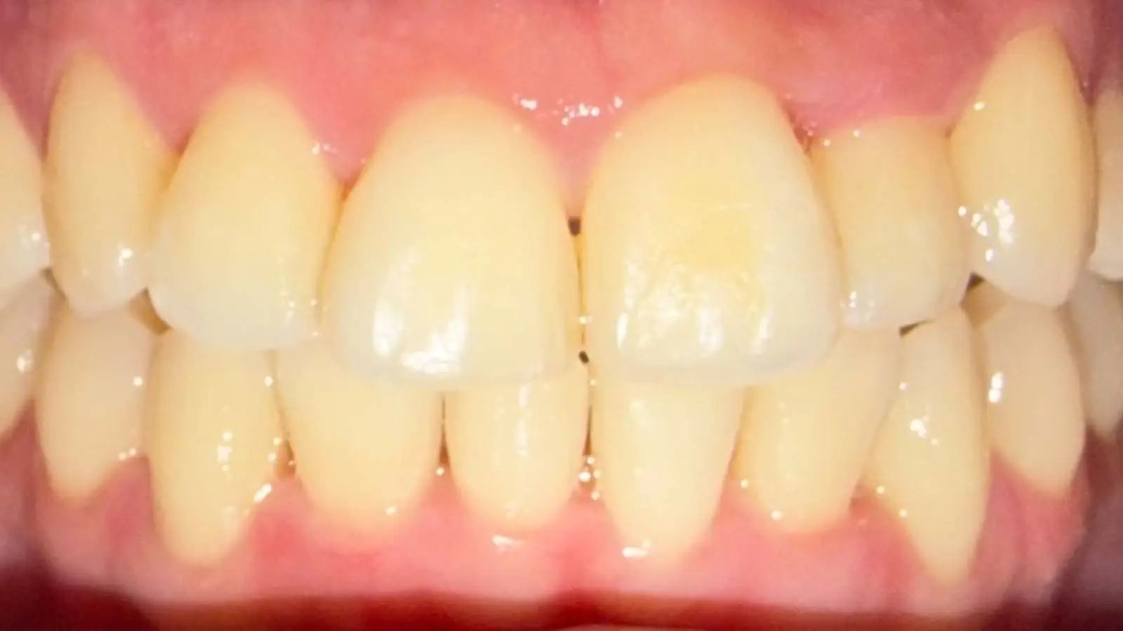 After image