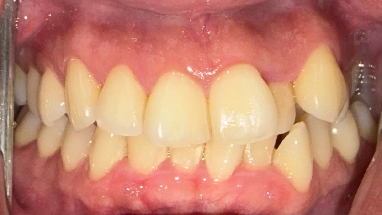 Before image